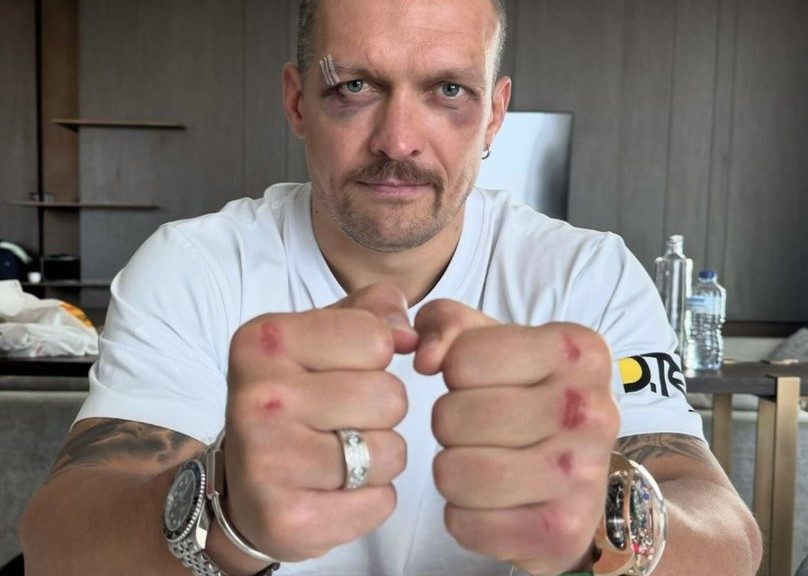 Don't Be fooled - Oleksandr Usyk Will have his hands full In A tyson fury Rematch - Vimarsana News