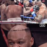 Jarrell ‘Big Baby’ Miller’s Toupee Tumble: How a Bizarre Boxing Moment Became Mainstream Media’s Latest Obsession