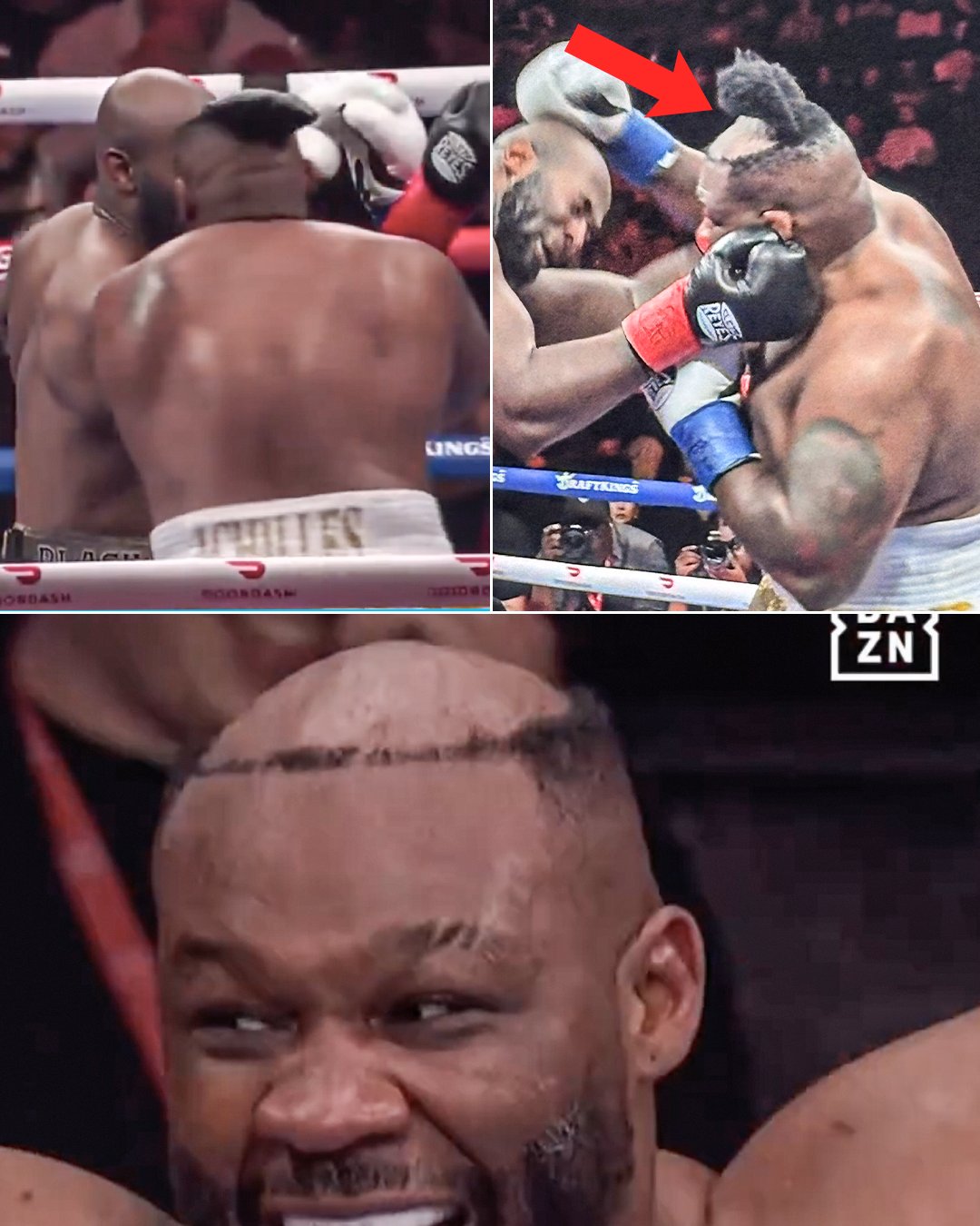 Jarrell ‘Big Baby’ Miller’s Toupee Tumble: How a Bizarre Boxing Moment Became Mainstream Media’s Latest Obsession